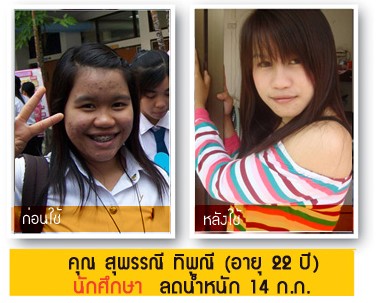 ลดน้ำหนักอย่างเร็ว ได้ผล