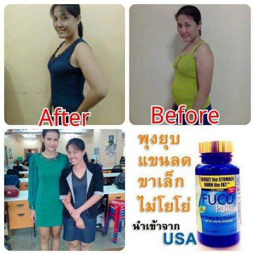 ฟูโก้เพียว-จากศูนย์แท้-ลดสัดส่วน-ลดน้ำหนักไม่โยโย่-089-33008