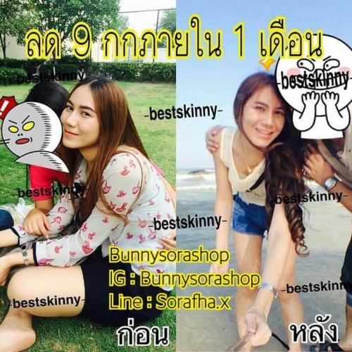 best-skinny-ยาลดน้ำหนักคลีนิค--สูตรล้มช้าง-ทะลุทะลวงไขมัน