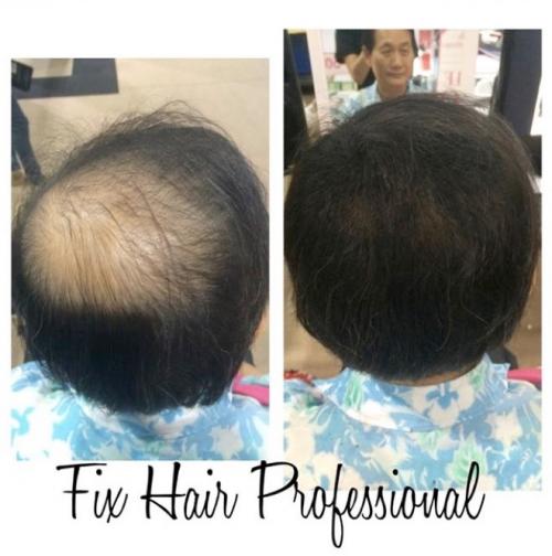 fix-hair-professional-ทำเองได้ง่ายๆที่บ้าน-เพิ่มความมั่นใจได