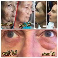 มิสเตอร์แทน-แนะนำ-ครีมลดถุงใต้ตา-ลดริ้วรอย-ย่น-by-instantly-