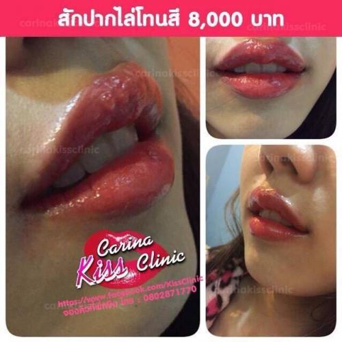 สักปากชมพู-สักหัวนมชมพู-ลบรอยสัก-สักโดยช่างมังกร-ติดต่อสอบถา