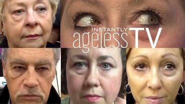 ageless-สินค้านำเข้าด้วยราคาไม่แพงลดถุงใต้ตา-ริ้วรอย