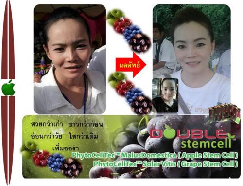 double-stemcell-อาหารเสริม-หน้าเด็ก-ผิวขาว-สวย-สุขภาพดี