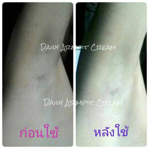 ครีมรักแร้ขาว-daily-armpit-cream-