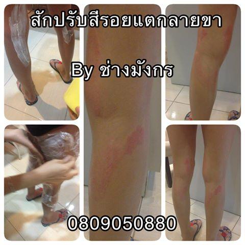 ลบรอยสัก-ลบรอยแตกลาย-โดยช่างมังกร-0809500880