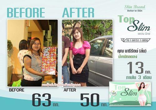 พิเศษ-ลดน้ำหนักราคาถูก-topslimซื้อ1แถม1