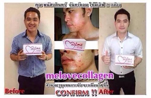 me-love-collagen-คอลาเจน