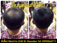 hair-fiber-ปิดผมบาง-เพิ่มผมหนา-ใน-1-นาที