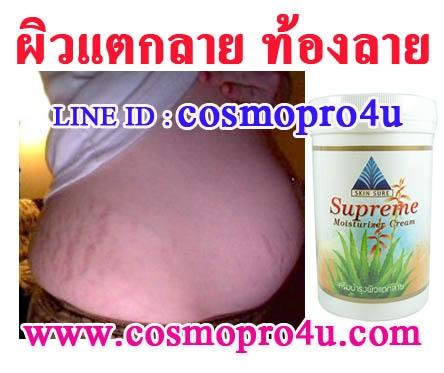 ครีมเพื่อลดรอยแตกลาย-ริ้วรอยย่น-ทั่วตัว-เพิ่งลาย-ลายนานแล้ว-